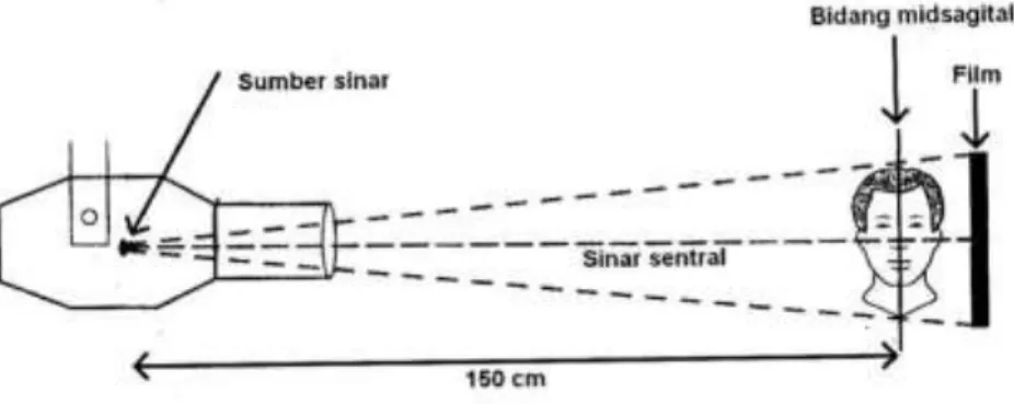Gambar 2.1  Gambar  skematik  untuk  mendapatkan  sefalo- sefalo-metri  standar,  jarak  sumber  sinar  ke  bidang  midsagital 150cm, jarak bidang midsagital ke film  15 cm (Jacobson, 2006) 