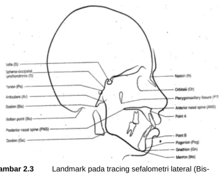 Gambar 2.3  Landmark pada tracing sefalometri lateral (Bis- (Bis-hara, 2001) 