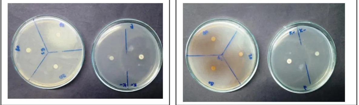 Fig 1. The inhibition zone on disk diffusion method of antibacterial activity of  Sticopus  hermanii  extract  (a)  and  Holoturia  atra  extract  (b)  in  serial  concentrations  of  20%,  40%,  80,  negative  control  (DMSO1%),  positive control tetracyc