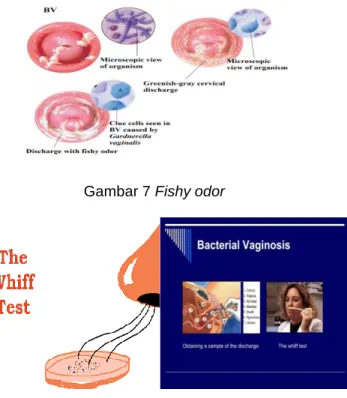 Gambar 7 Fishy odor 