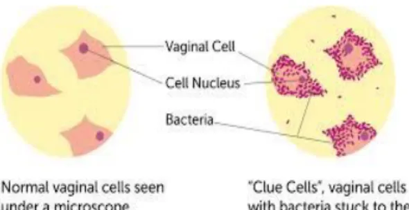 Gambar 9 Clue cells 