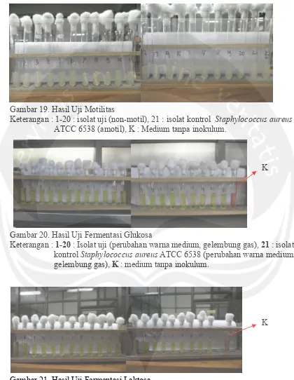 Gambar 21. Hasil Uji Fermentasi LaktosaKeterangan : 1-20 : Isolat uji (perubahan warna medium, gelembung gas), 21 : isolat kontrol Staphylococcus aureus ATCC 6538 (perubahan warna medium, gelembung gas), K : medium tanpa inokulum.