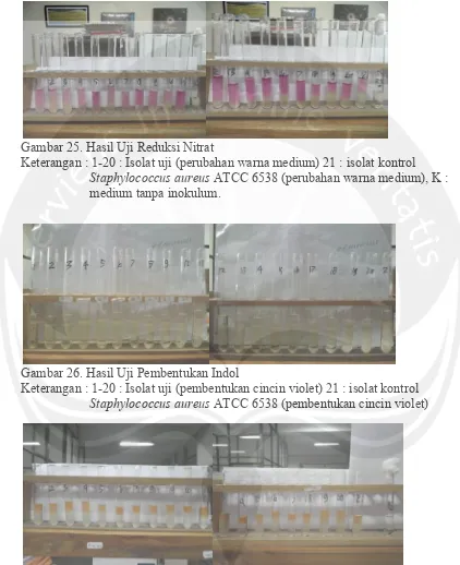 Gambar 25. Hasil Uji Reduksi Nitrat