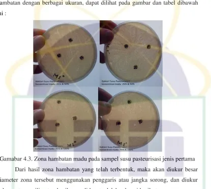 Tabel 4.5. Hasil pegukuran diameter zona hambatan yang ditimbulkan oleh madu 
