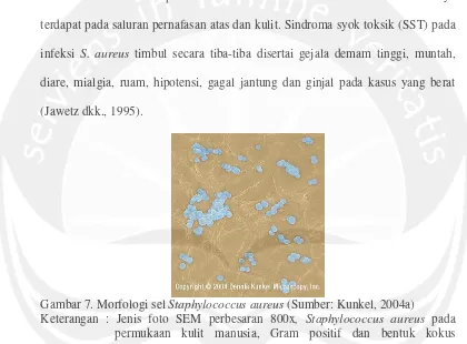 Gambar 7. Morfologi sel  Staphylococcus aureus (Sumber: Kunkel, 2004a) 