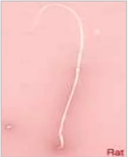 Gambar 3. Spermatozoa tikus (Rouge, 2004). 