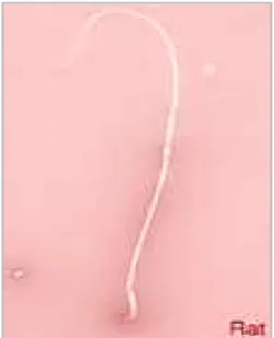 Gambar 3. Spermatozoa tikus (Rouge, 2004). 