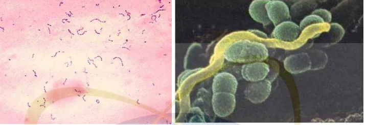 Gambar 2.2 Streptococcus mutans dengan Pewarnaan Gram Positif 