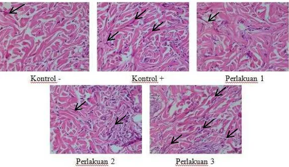 Gambar 4.2. Sel Fibroblas (panah) Pada Jaringan Granulasi Luka Bakar Tikus   
