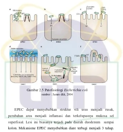 Gambar 2.5 Patofisiologi Escherichia coli 