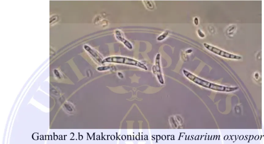 Gambar 2.b Makrokonidia spora Fusarium oxyosporum  Sumber: (Damayanti,2009) 