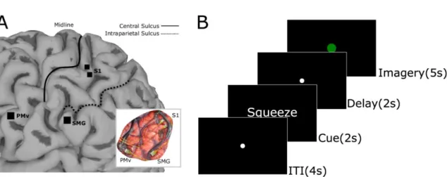 Figure 3.1 Implant locations and task design 