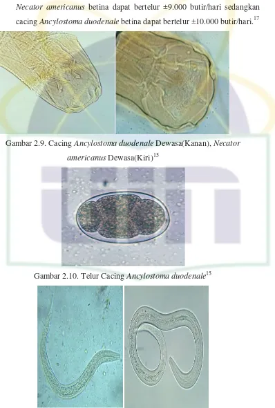 Gambar 2.9. Cacing Ancylostoma duodenale Dewasa(Kanan), Necator 