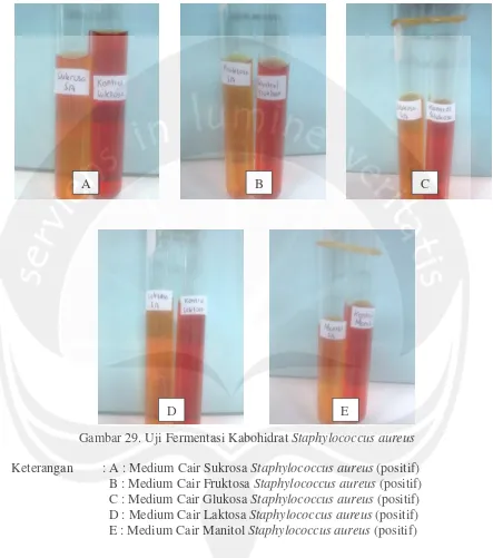 Gambar 29. Uji Fermentasi Kabohidrat Staphylococcus aureus 