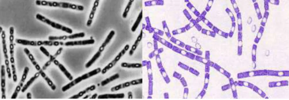 Gambar 3. Bacillus anthracis (Leslie, 2004) 