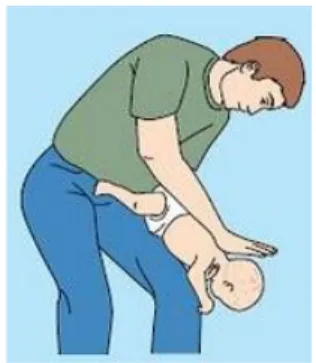 Gambar 2.7. Back Blow 