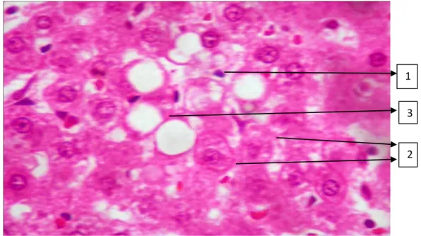 Gambar 5.3 Histologi Hati pada Kelompok Kontrol dengan Pembesaran 400x  Keterangan: 