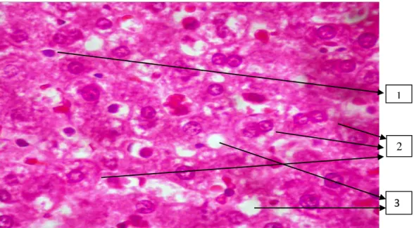 Gambar 5.2 Histologi Hati pada Kelompok Kontrol dengan Pembesaran 400x  Keterangan: 