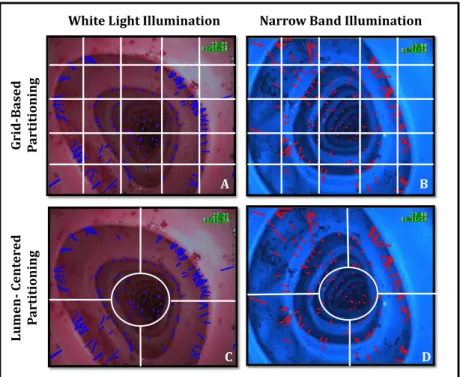 Figure 5.3: Typical optical flow patterns for a 5 mm translation along the Z axis with com- com-binations of illumination modalities and spatial partitions