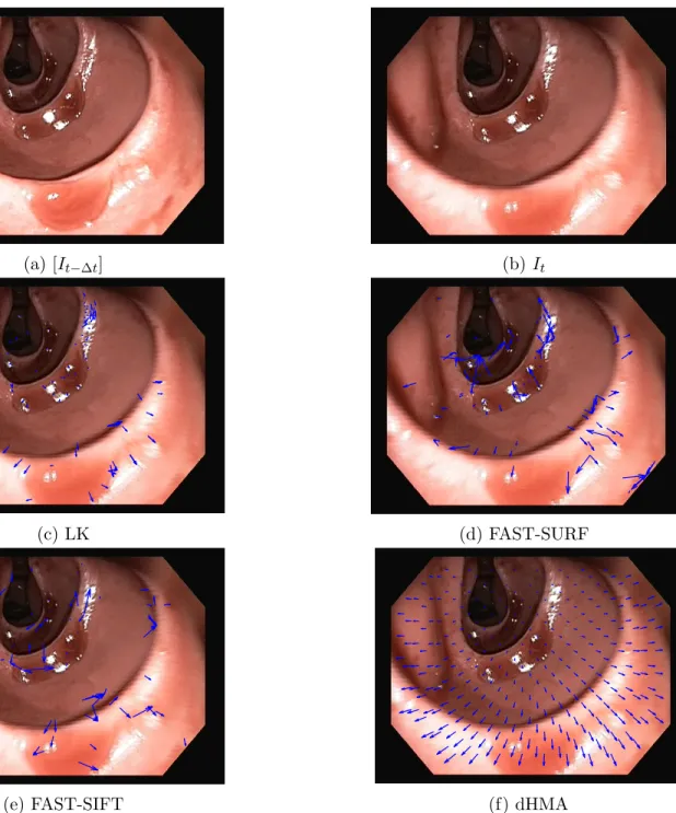 Figure 5.9: Comparison of optical flow vectors produced in a worse-case scenario.