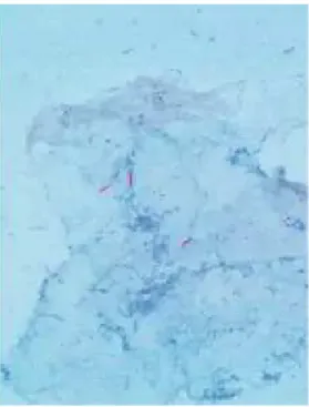 Gambar 2.1 Hapusan basilus tahan asam memperlihatkan