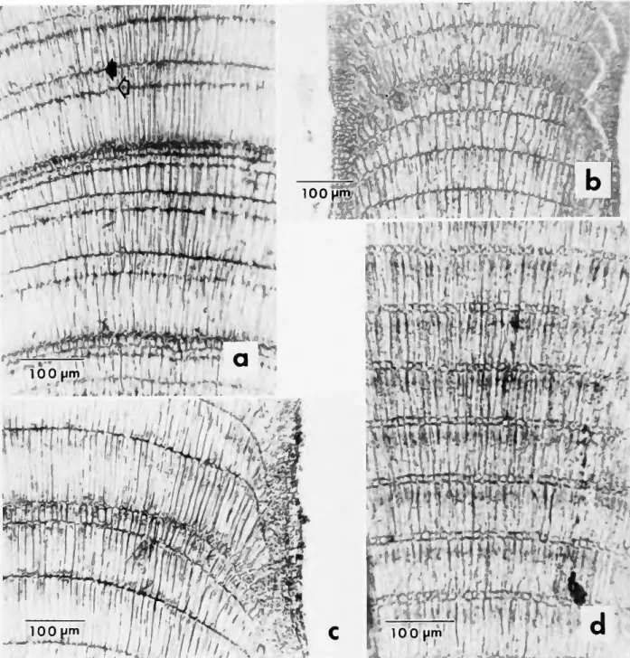 FIGURE 4.—Longitudinal sections of intergenicula: a, Amphiroa beauvoisii (JN &amp; HWJ-73-7-31)  (note arching lines of primary pit connections (solid arrow) and secondary pit connections  (open arrow), which are about one-third below tops of cells); b, A