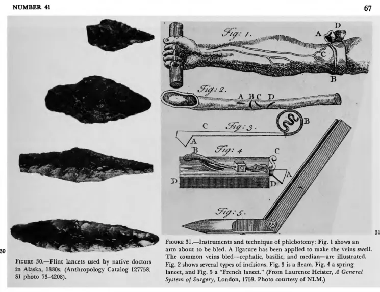 FIGURE 30.—Flint lancets used by native doctors  in Alaska, 1880s. (Anthropology Catalog 127758; 