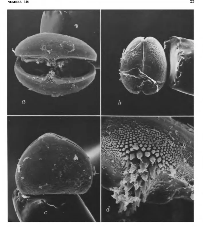 FIGURE 6.—Glochidia of Alasmidonta viridis: a-d, OSUM 9656 (location same as 5c). (a X 250;