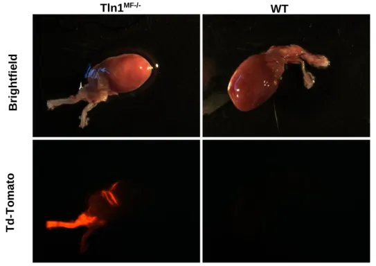Figure 6: Postn-Cre activation after TAC. Pictures of WT and Tln1 MF-/-  hearts and carotid arteries under  brightfield and Td-Tomato filters 6 weeks post-TAC