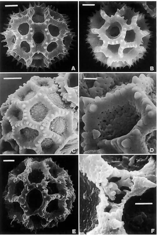 FIGURE  5.-SEM  of pollen  of Vemonieae (all  US):  A,  Lepidaploa chalybaea (Mart.  ex DC.)  H
