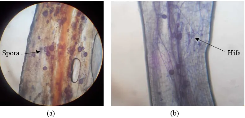 Gambar 10. Infeksi pada akar bibit suren, (a) terinfeksi spora (b) terinfeksi hifa 