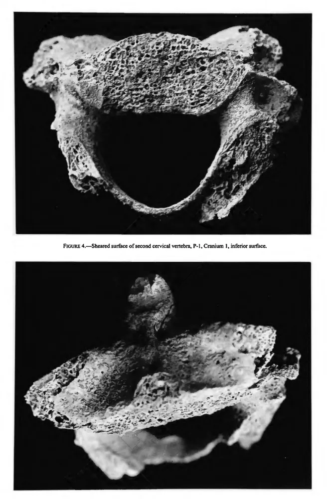 FIGURE 5.—Sheared surface of second cervical vertebra, P-l, Cranium 1, ventral surface