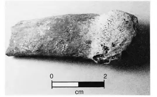 FIGURE  11.—Healed fracture on sternal end of right rib, P-4, E-1B. 