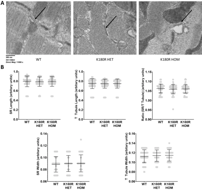 Figure  13.  Electron  microscopy  of  WT  and  K180R  cardiomyocytes.  Thin  section  low  power  electron microscopy of cardiac muscle showing Casq2 (arrows) filled junctional SR in wild-type  (WT) and the 2 K180R mutants