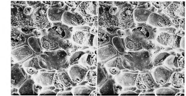 FIGURE 29.—Stereophotomicrographs of the castrum of the holotype of Agrenocythere spinosa,  new species (x200)