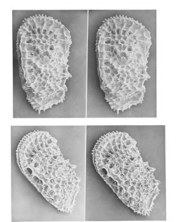FIGURE 31.—Stereophotomicrographs of * hypotype (USNM 174345), an adult, female left  valve, of Agrenocythere hazelae (van den Bold, 1946), from the Recent of the eastern Caribbean  Sea (ALB 2751), as seen from left lateral, and left anteroventral oblique 