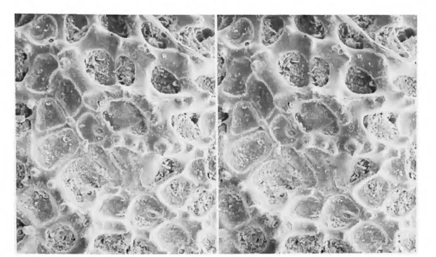 FIGURE 32.—Stereophotomicrographs of the castrum of a hypotype of Agrenocythere hazelae  (van den Bold, 1946) (same specimen as Figure 31, x200)