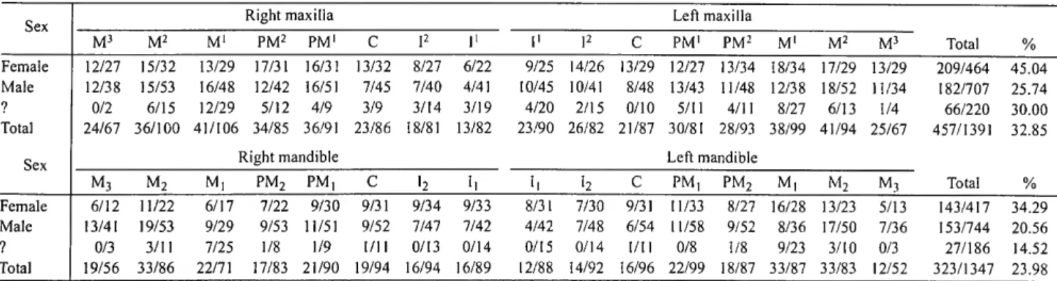 Table 13 presents data on the various locations of carious le- sions. Both in the maxilla (listed first) and the mandible,  le-sions were most commonly found on interproximal surfaces  (55.5%, 49.9%) followed by occlusal surfaces (15.7%, 15.7%)