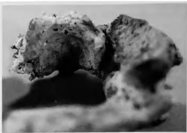 FIGURE 29.—Arthritic condition on first cervical vertebra, burial 32. 