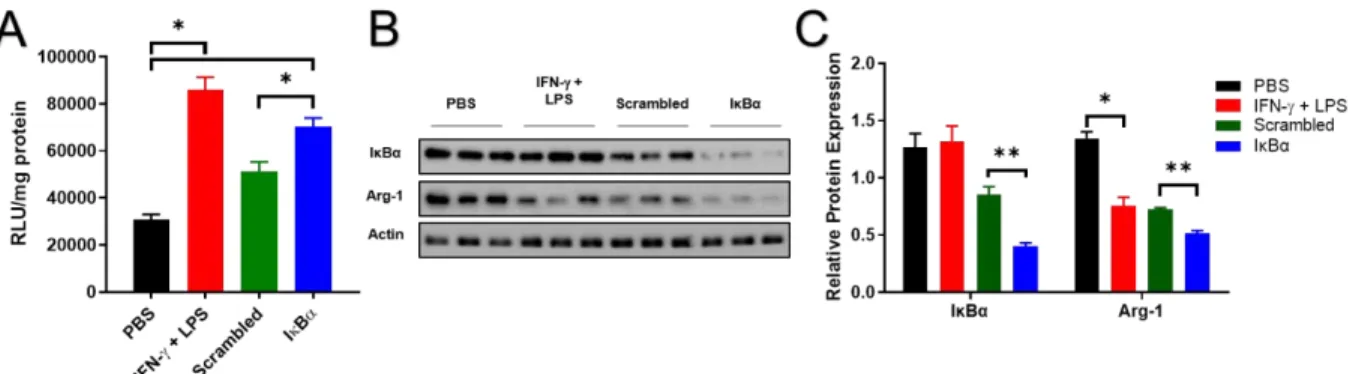 Figure 2.6: BMDM-NGL cells were polarized towards M2, followed by treatment with PBS, IFN-γ and LPS, or  mannose-decorated polyplexes containing scrambled or IκBα-targeting siRNA