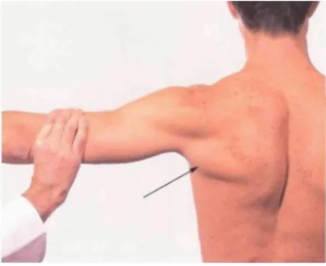 Fig. 15 Teres Major (Subscapular nerve; C5, C6, C7) The patient is adducting the elevated upper arm against resistance.