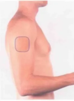 Fig. 20 The approximate area within which sensory changes may be found in lesions of the axillary nerve.