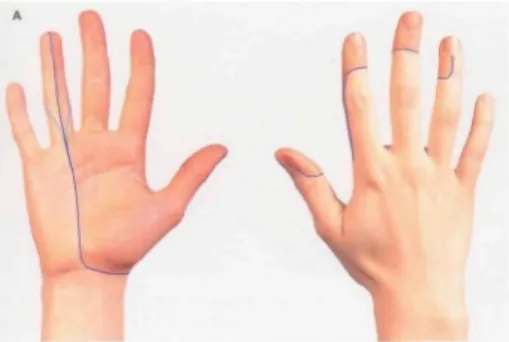 Fig. 36 The approximate areas within which sensory changes may be found in lesions of the median nerve in: A the forearm, B the carpal tunnel.