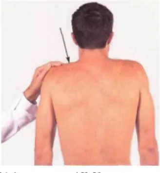 Fig. 1 Trapezius (Spinal accessory nerve and C3, C4) The patient is elevating the shoulder against resistance.