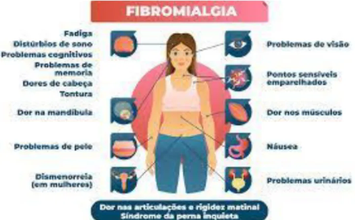 Gambar 7. Fibromialgia 