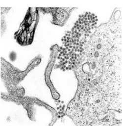 Gambar 3. Gambar yang diperbesar menunjukkan virus dengue (the  cluster of dark dots near the center)