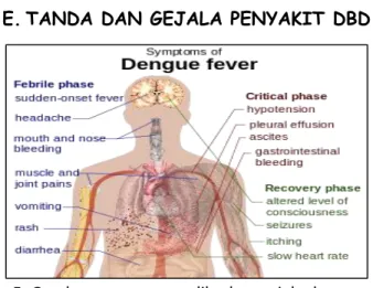 Gambar 5. Gambar yang memperlihatkan gejala demam dengue 