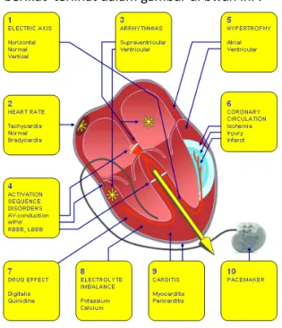 Gambar 4.3 Sirkulasi jantung C.1. Penentuan Sumbu Elektrik Jantung