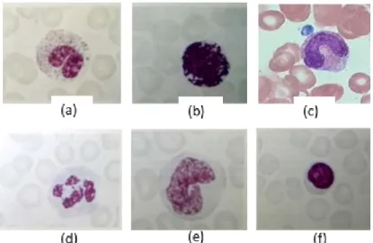 Gambar 1.4 Jenis-jenis Leukosit: (a) eosinofil; (b) basofil; (c) neutrofil stab; (d) neutrofil segmen; (e) limfosit;
