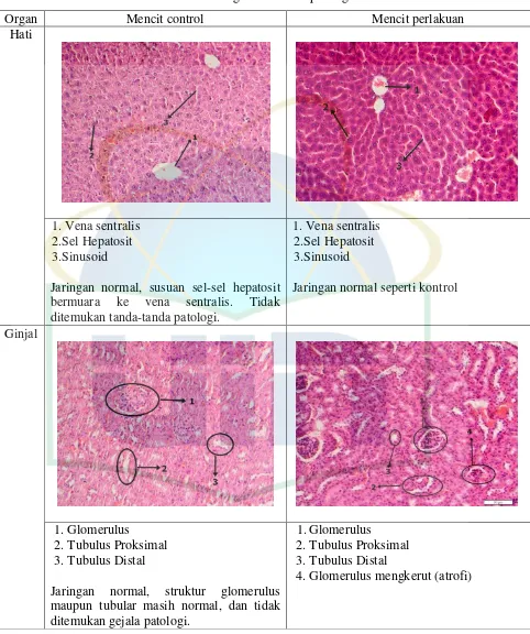 Tabel. 4.2 Hasil Pengamatan Histopatologi 